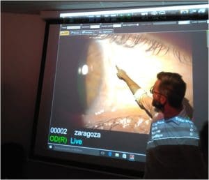 Curso sobre lentes esclerales en Zaragoza-Diego López Alcón